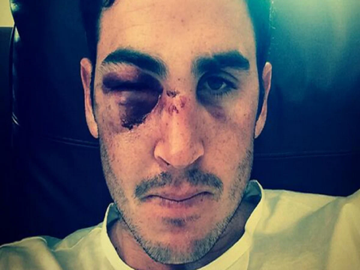 Craig Kieswetter
