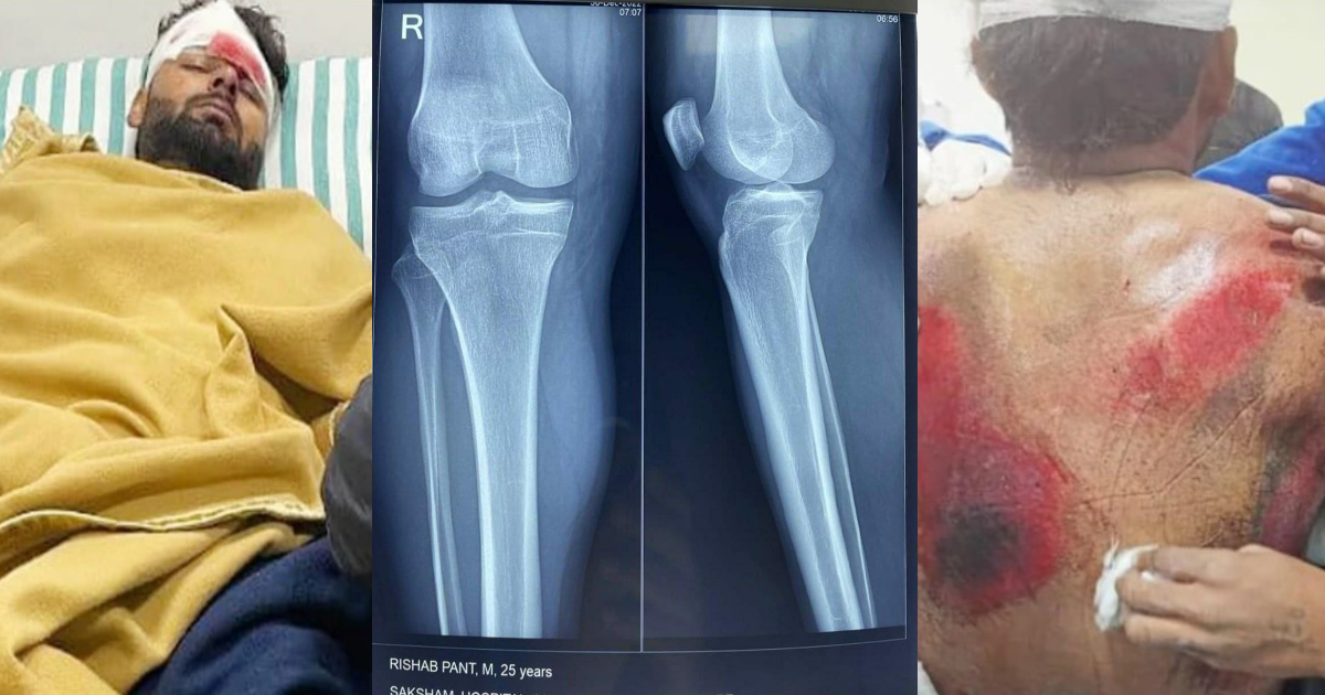 Rishabh Pant MIR and Spine Scan reports
