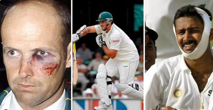 Cricket - Cricketers Who Played with Injury